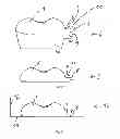 Fig. 02 - Method for producing trays for brackets