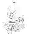 Fig. 02 - CLEAR ALIGNER AND MANUFACTURING METHOD THEREOF, TRACTION DEVICE FOR CLEAR ALIGNER, AND AID FOR TRACTION DEVICE FOR CLEAR ALIGNER