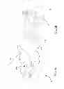 Fig. 06 - Multi Functional Implanting Suite and Implanting Method Thereof