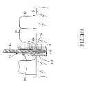 Fig. 67 - Multi Functional Implanting Suite and Implanting Method Thereof