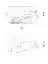 Fig. 02 - Method of attaching a dental component to a dental implant