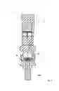 Fig. 02 - Dental superstructure attaching system and methods for attaching a dental superstructure to a dental implant