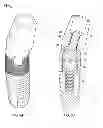 Fig. 06 - Polyaxial dental implant system