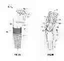 Fig. 09 - Polyaxial dental implant system