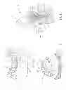 Fig. 02 - REMOVABLE DENTAL IMPLANT BRIDGE SYSTEM