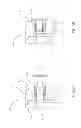 Fig. 06 - REMOVABLE DENTAL IMPLANT BRIDGE SYSTEM