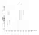 Fig. 04 - Methods of detecting reverse triiodothyronine by mass spectrometry