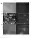 Fig. 19 - FLUORESCENT NITRIC OXIDE PROBES AND ASSOCIATED METHODS
