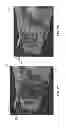 Fig. 13 - Methods, apparatuses and systems for mid-plane mounting parallel optical communications modules on circuit boards