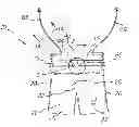 Fig. 01 - Inflatable bathing suit system