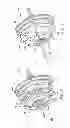 Fig. 06 - Continuously variable bicycle transmission mechanism and bicycle hub