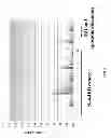Fig. 06 - METHODS FOR IDENTIFYING INFLAMMATORY BOWEL DISEASE PATIENTS WITH DYSPLASIA OR CANCER