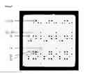Fig. 09 - Microarrays