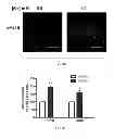 Fig. 06 - Materials and Methods Related to Sodium/Potassium Adenosine Triphosphatase and SRC