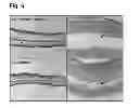 Fig. 08 - Peptides that stimulate subcutaneous adipogenesis