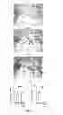 Fig. 08 - THERAPEUTIC AGENT FOR ECTOPIC PREGNANCY