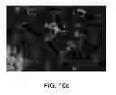 Fig. 08 - METHODS FOR TREATING VASCULAR LEAK SYNDROME