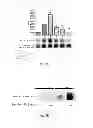 Fig. 08 - Methods of treating hemoglobinopathies