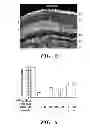 Fig. 03 - USE OF CHELATORS OF DIVALENT CATIONS TO PROMOTE NERVE REGENERATION