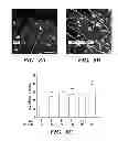 Fig. 08 - USE OF CHELATORS OF DIVALENT CATIONS TO PROMOTE NERVE REGENERATION