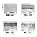 Fig. 12 - USE OF CHELATORS OF DIVALENT CATIONS TO PROMOTE NERVE REGENERATION