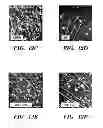 Fig. 16 - USE OF CHELATORS OF DIVALENT CATIONS TO PROMOTE NERVE REGENERATION
