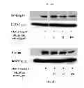 Fig. 06 - PHARMACEUTICAL COMPOSITION CONTAINING OLEANOLIC ACID ACETATE AS AN ACTIVE INGREDIENT FOR PREVENTING OR TREATING TLR- OR IL-6-MEDIATED DISEASES