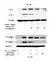 Fig. 08 - PHARMACEUTICAL COMPOSITION CONTAINING OLEANOLIC ACID ACETATE AS AN ACTIVE INGREDIENT FOR PREVENTING OR TREATING TLR- OR IL-6-MEDIATED DISEASES
