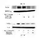 Fig. 09 - PHARMACEUTICAL COMPOSITION CONTAINING OLEANOLIC ACID ACETATE AS AN ACTIVE INGREDIENT FOR PREVENTING OR TREATING TLR- OR IL-6-MEDIATED DISEASES