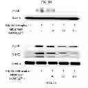 Fig. 10 - PHARMACEUTICAL COMPOSITION CONTAINING OLEANOLIC ACID ACETATE AS AN ACTIVE INGREDIENT FOR PREVENTING OR TREATING TLR- OR IL-6-MEDIATED DISEASES