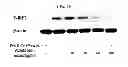 Fig. 11 - PHARMACEUTICAL COMPOSITION CONTAINING OLEANOLIC ACID ACETATE AS AN ACTIVE INGREDIENT FOR PREVENTING OR TREATING TLR- OR IL-6-MEDIATED DISEASES