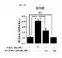 Fig. 15 - PHARMACEUTICAL COMPOSITION CONTAINING OLEANOLIC ACID ACETATE AS AN ACTIVE INGREDIENT FOR PREVENTING OR TREATING TLR- OR IL-6-MEDIATED DISEASES