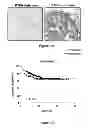Fig. 05 - MARKERS FOR DCIS RECURRENCE: COORDINATE PTEN/RB LOSS