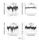 Fig. 07 - MODULE-LEVEL ANALYSIS OF PERIPHERAL BLOOD LEUKOCYTE TRANSCRIPTIONAL PROFILES