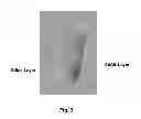 Fig. 04 - Chromatography column and method for isolating nucleic acid