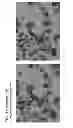 Fig. 17 - Forms of rifaximin and uses thereof