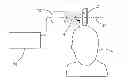 Fig. 01 - Systems and methods for neuro-EEG synchronization therapy