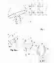 Fig. 02 - METHOD AND SYSTEM FOR POSITIONING A TRANSCRANIAL MAGNETIC STIMULATION (TMS) DEVICE