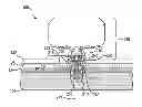 Fig. 01 - PROSTHESIS ADAPTER