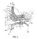 Fig. 02 - PROSTHESIS ADAPTER