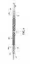 Fig. 07 - Kit for Placing Fixation Devices
