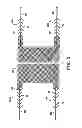 Fig. 08 - Kit for Placing Fixation Devices