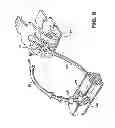 Fig. 11 - Kit for Placing Fixation Devices