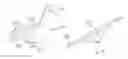 Fig. 05 - Gastric Constriction Device