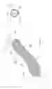 Fig. 12 - Gastric Constriction Device
