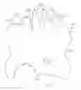 Fig. 16 - Gastric Constriction Device