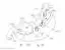 Fig. 17 - Gastric Constriction Device