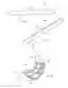 Fig. 21 - Gastric Constriction Device
