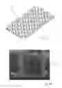 Fig. 25 - Gastric Constriction Device