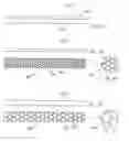 Fig. 26 - Gastric Constriction Device